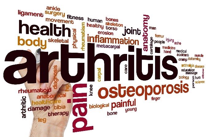 https://cornellpainclinic.com/wp-content/uploads/2018/09/Arthritis.jpg