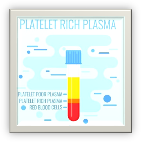 Platelet Rich Plasma Injection
