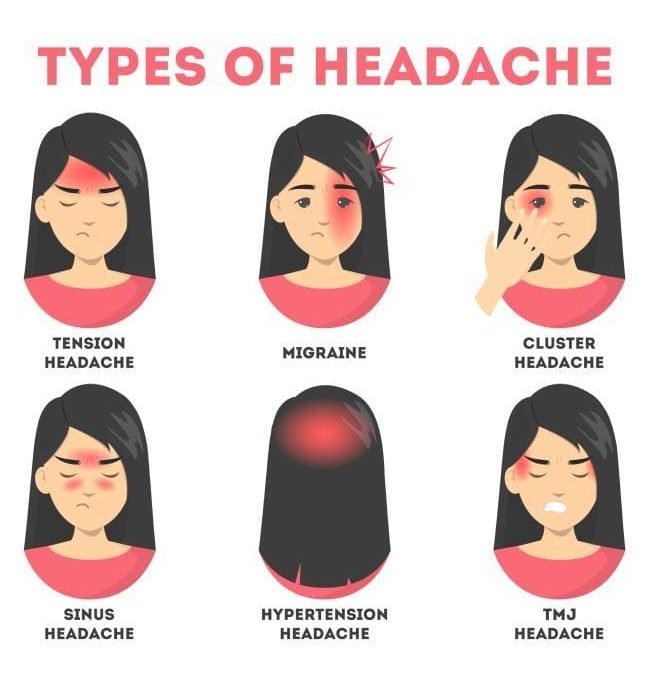 Headache Chart Types By Symptoms Location And Causes